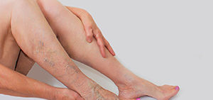 ic-elhanyagolt-visszerproblemak